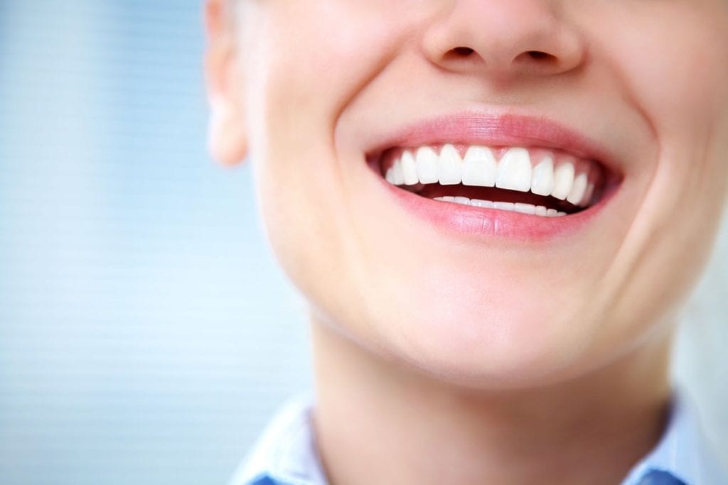 Keep Teeth Bright After Professional Whitening