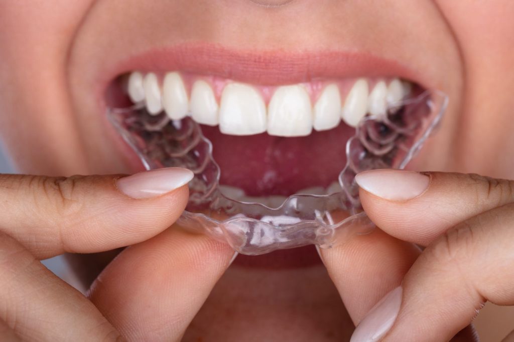straighten teeth with Invisalign in Frederick Maryland
