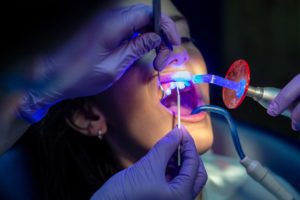 patient undergoing procedure with lasers dentists in Frederick Maryland