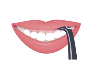 Laser Dentistry Safety